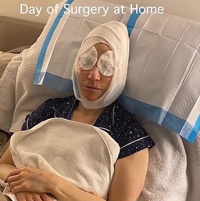 Ellen w dniu operacji.