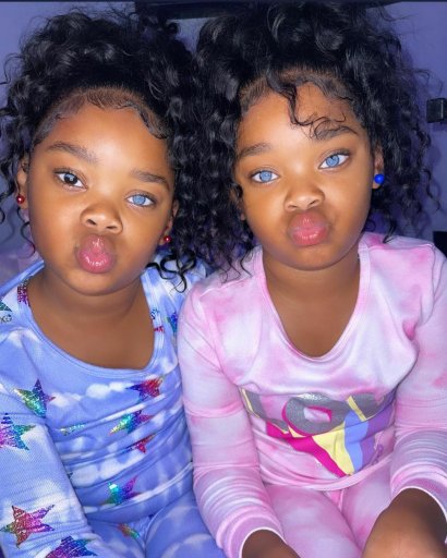 Ta para bliźniaczek jest jedną z 20 najbardziej wyjątkowych na świecie! Wszystko przez ich oczy!