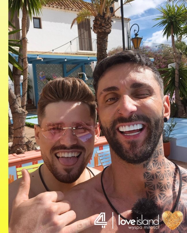 Jak Dan Kowalski z “Love Island 9” wyglądał z prawdziwymi zębami